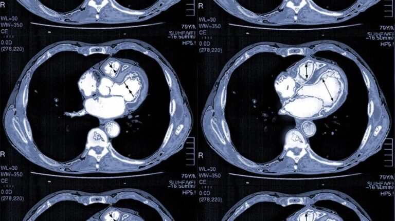 How Cardiologists Use Imaging To Diagnose Heart Disease