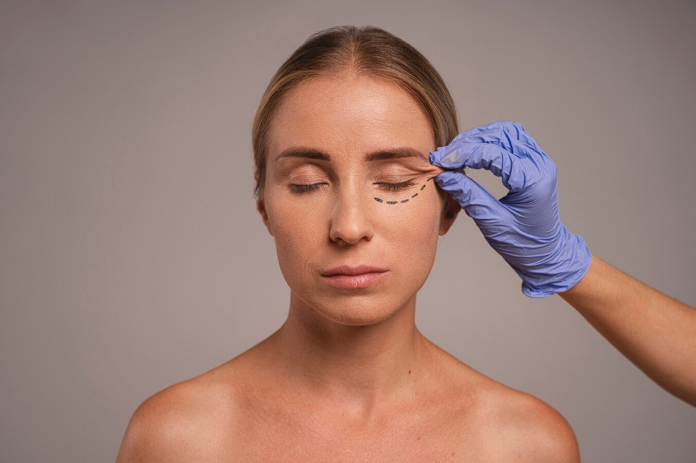 Lower and Upper Blepharoplasty in Dublin