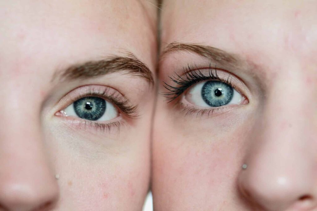 Brow Lift